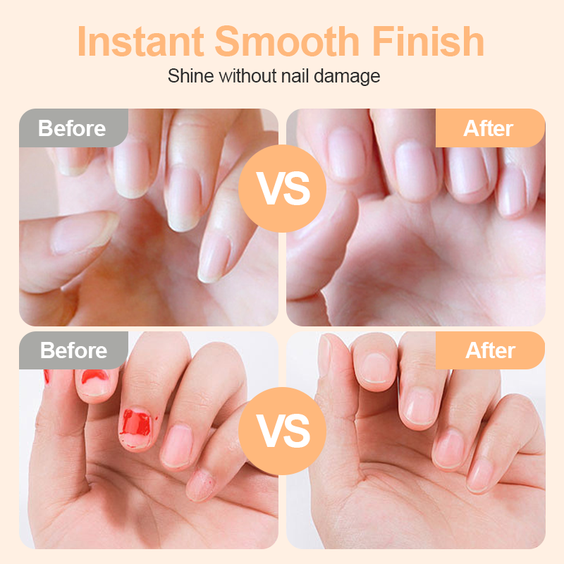 2-in-1 Safe Electric Nail Clipper ¨C Trims, Grinds & Polishes with LED Light.